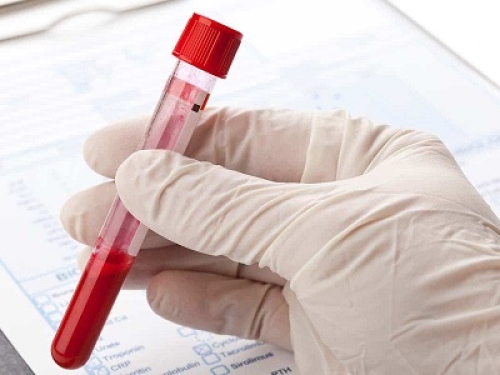 Per il sequestro di sangue in provetta prelevato in ospedale non serve il consenso